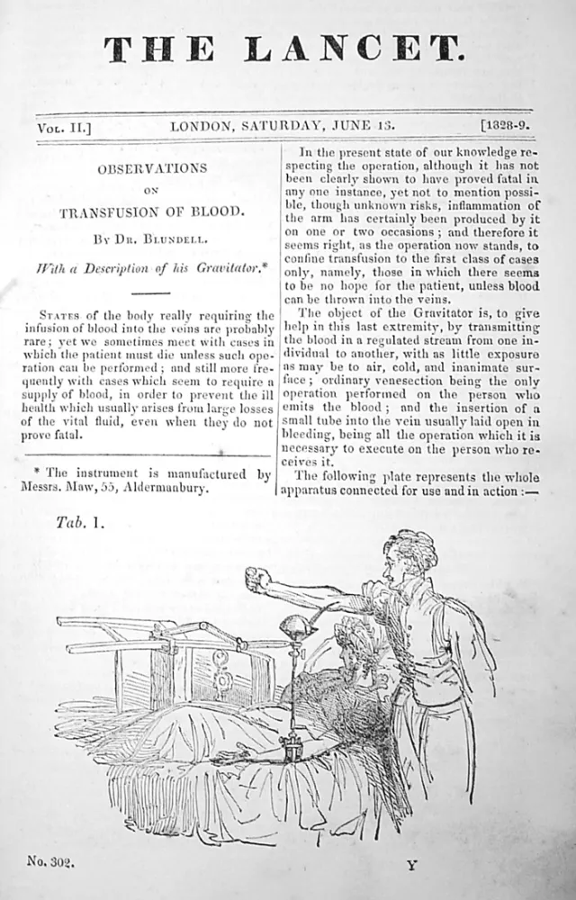 Článek o transfuzích od Dr. Blundella v časopise The Lancet z roku 1829